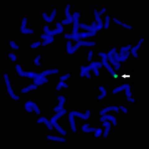Sonda de Cromosoma 4qter