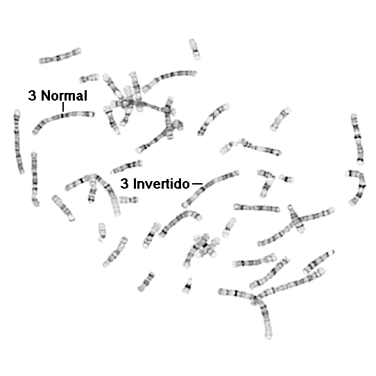 clula en metafase con inversin en cromosoma 3