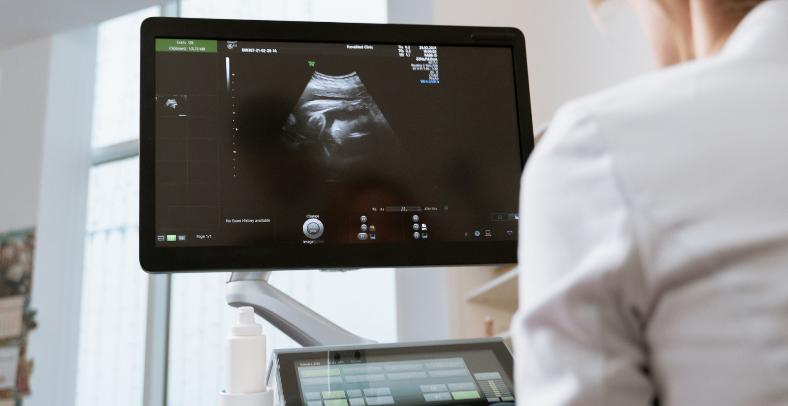 Relacionan la distribución de la grasa abdominal con parámetros de sarcopenia